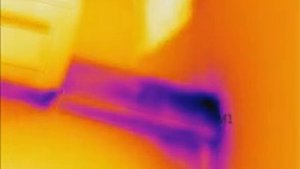 Обследование тепловизором