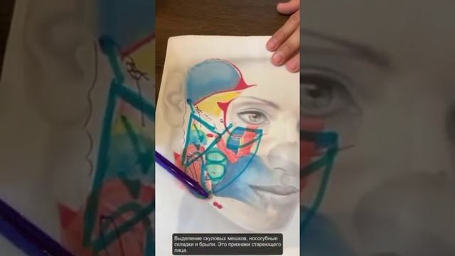спейслифтинг
