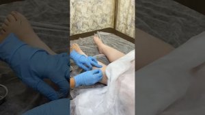 Постановка иголок ребёнку от энуреза
