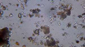 что можно увидеть в капле грязной воды   под микроскопом