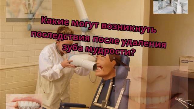 Какие могут возникнуть последствия после удаления зуба мудрости? смотреть онлайн