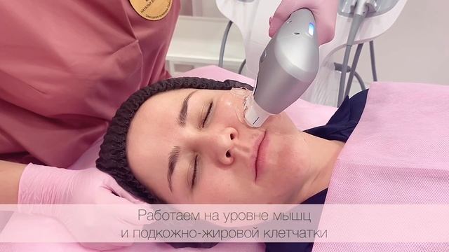SMAS-лифтинг на аппарате Ultraformer (Ультраформер)
