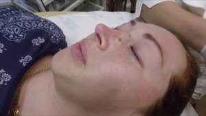 19. Удаление новообразований на лице (бородавок, кератом, папиллом, родинок)