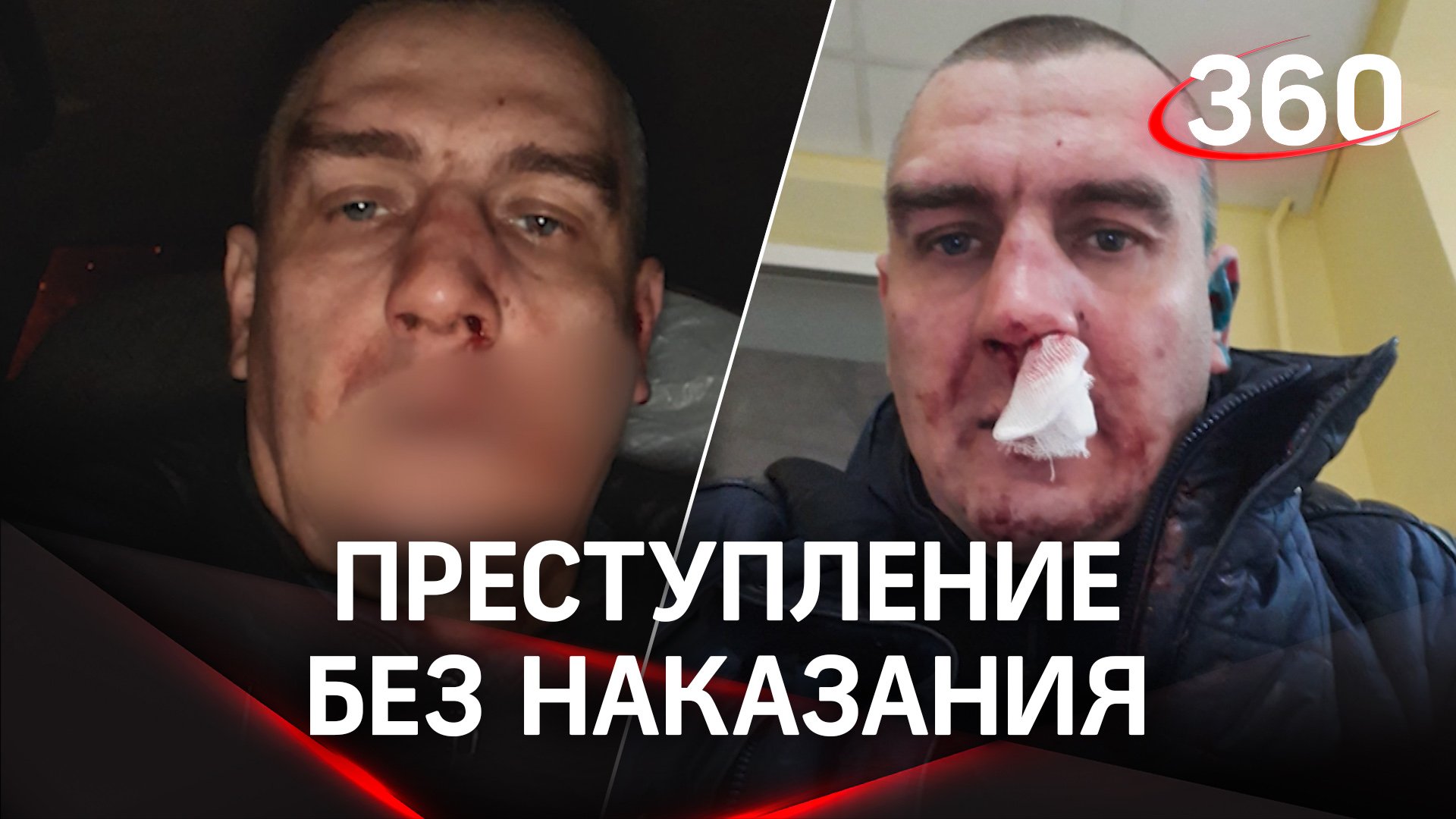 «Преступление без наказания» - В Москве избитый бизнесмен не может добиться правосудия