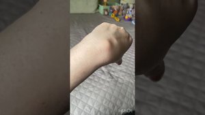 Обнаружила шишку на руке 😕 Гигрома
