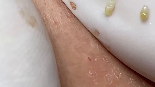 Enjoy Every Day With The Best Video Loan Nguyen Spa Official 2643 смотреть онлайн