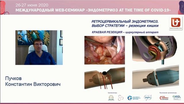 Лекция проф. Пучкова Хирургическое лечение инфильтративного эндометриоза от А до Я