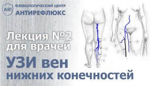 УЗИ вен лекция 2. Схема ультразвукового сканирования вен