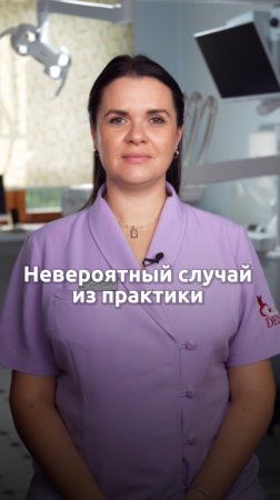 Пациент словил радиоволну через пломбу 🦷 #стоматология #пломба