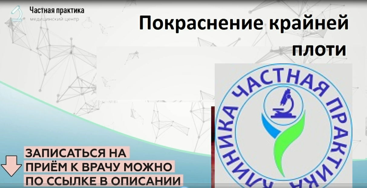 Покраснение крайней плоти