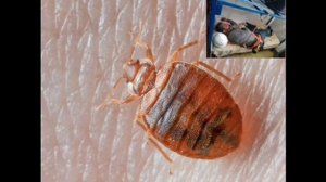 Клапа хакида