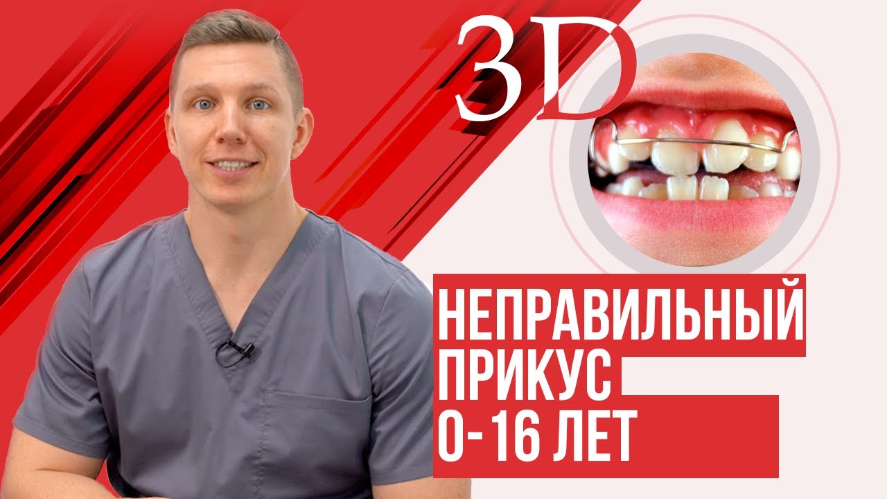 Неправильный прикус, профилактика и исправление у детей
