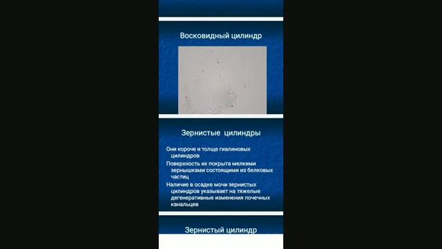 qon hujayralari mikroskopiyasi peshob ( siydik )dagi patologik hujayralar