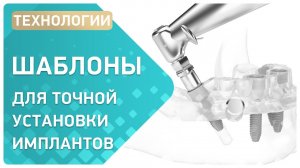 Производство хирургических шаблонов для имплантации зубов