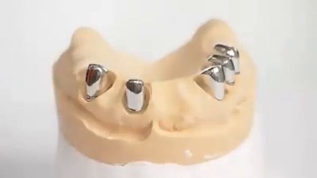 Телескопическая система фиксации