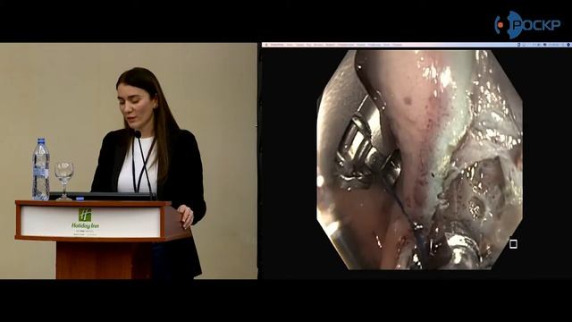 С.В.Джантуханова: Эндоскопические внутрипросветные технологии в колоректальной хирургии смотреть онлайн