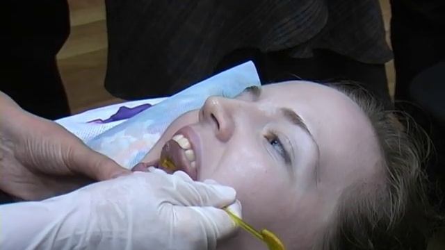 Коррекция звукопроизношения при помощи зондов