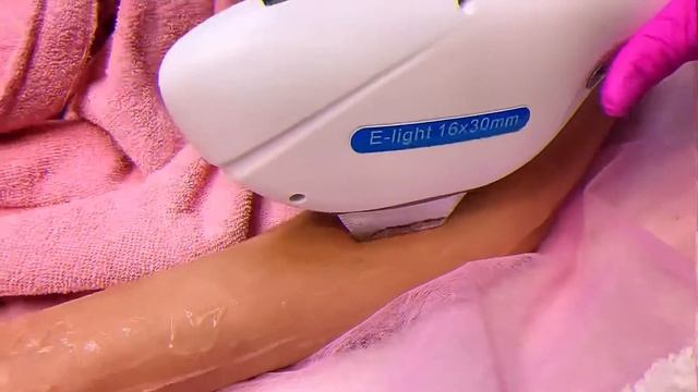 Лазерная Эпиляция смотреть онлайн