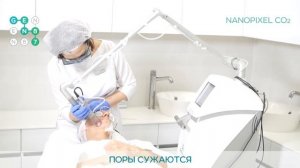 ГЛУБОКАЯ ЛАЗЕРНАЯ ШЛИФОВКА NANO PIXEL CO₂ Сеть клиник косметологии GEN87(2)