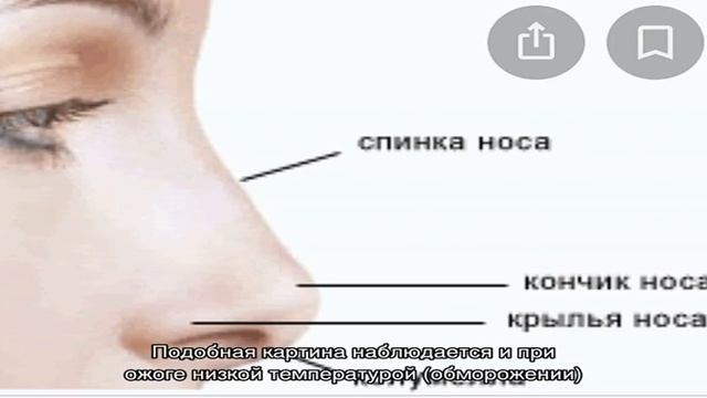 Крылья носа - что это такое смотреть онлайн