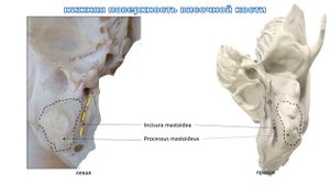 височная кость