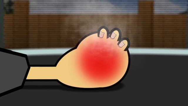 Science for kids  Body Parts - Unluckiest Kid Compilation!  Experiments for kids  Operation Ouch