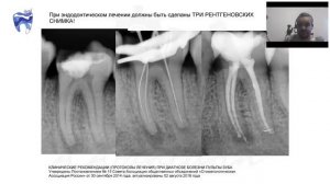 Вебинар №2 благотворительный. Основы рентгенодиагностики для эдодонтиста