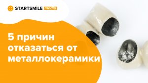 Главные минусы металлокерамических коронок!