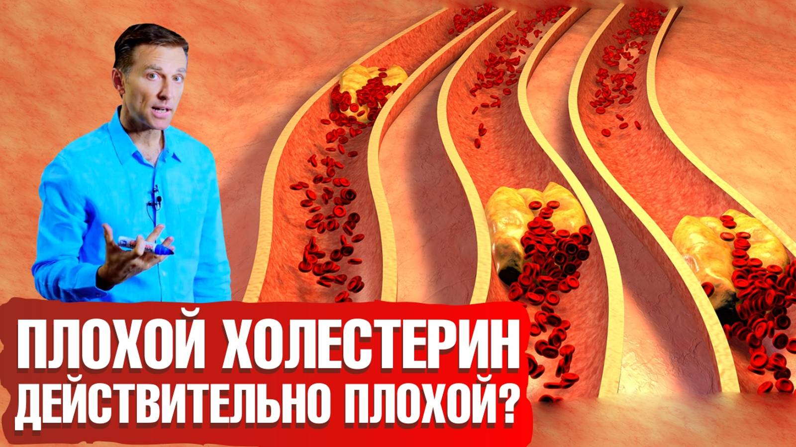 Какой холестерин - плохой? 🤷♀️ ЛПНП - не плохой?! Как снизить холестерин