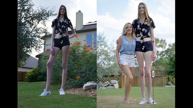 ШОК!!!Девушка c самыми длинными ногами на планете попала в книгу рекордов Гиннесса смотреть онлайн