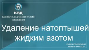 233  Удаление натоптышей жидким азотом