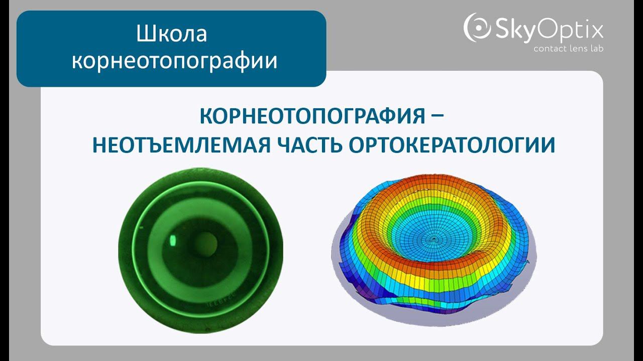 Школа корнеотопографии:  Корнеотопография - неотъемлемая часть ортокератологии