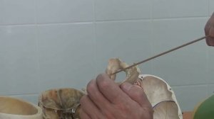 Затылочная кость 1