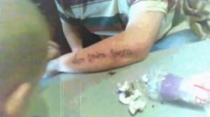 Прошлась по коже иголка-иголочка...