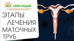 ? Комплексное лечение патологий маточных труб. Лечение маточных труб. Лейб Медик. 12+