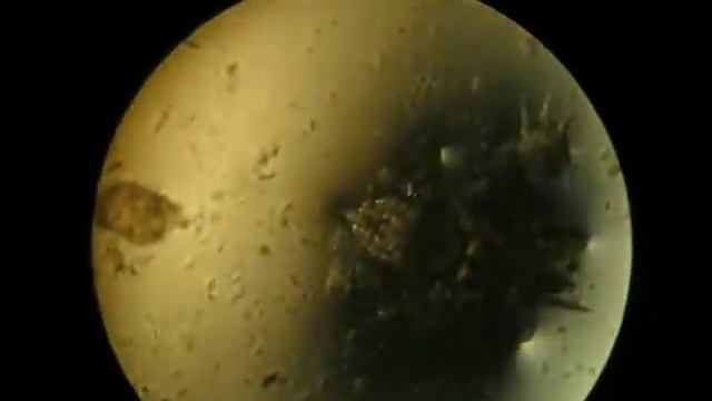 Ear Mites смотреть онлайн