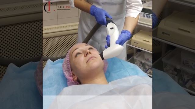 Преображение Анастасии Часть 3. RF лифтинг смотреть онлайн