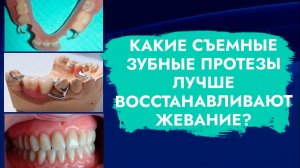 Съёмные зубные протезы. Пережевывание пищи. Какие протезы эффективнее?