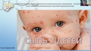 Сыпи у детей