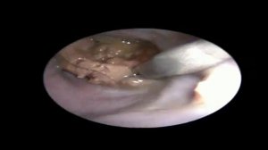 Эндоскопическое удаление инородных тел пищевода у собак и кошек.