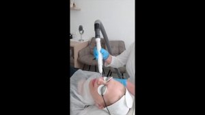 4D лазерное омоложение Fotona