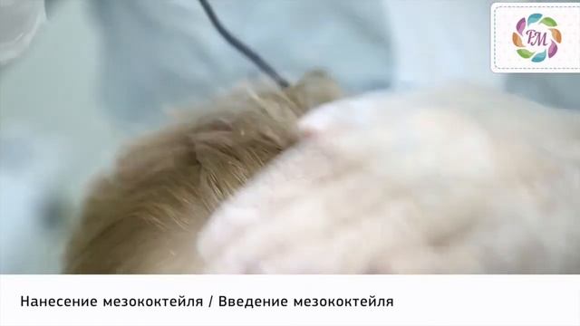 Фракционная мезотерапия кожи головы | Процедура Роял Медик смотреть онлайн