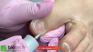 АППАРАТНЫЙ ПЕДИКЮР. ПРЕОБРАЖЕНИЕ.