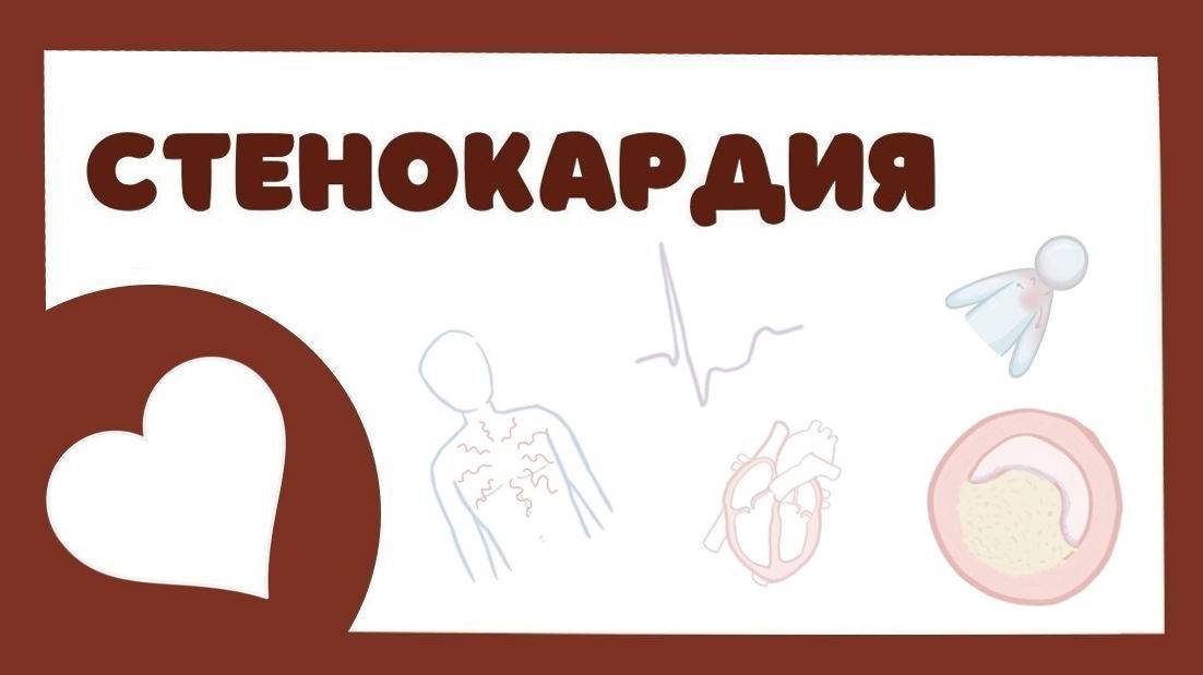 Стенокардия - причины, симптомы, лечение (лекция) Osmosis