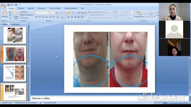 Fat Normalize. Особливості засосування. смотреть онлайн