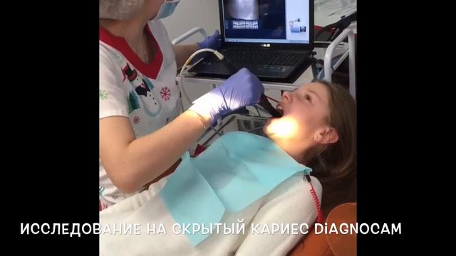 Диагностика кариеса