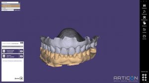 Применение нейросети, улучшающей качество фотографии для Exocad Smile Design