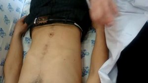 Пальпация живота