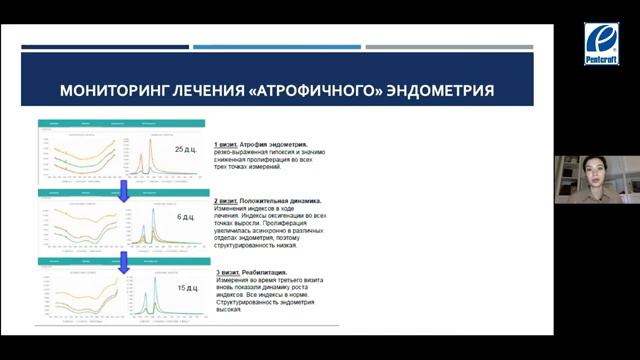 Вебинар 16.06 _Возможности экспресс-диагностики состояния эндометрия при бесплодии_, Флорова В.С. смотреть онлайн