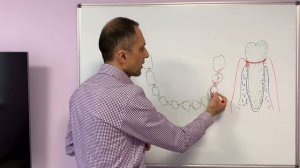 Почему зубы съезжают? Деформация зубных рядов после удаления зуба Удаление зуба с кистой Периодонти